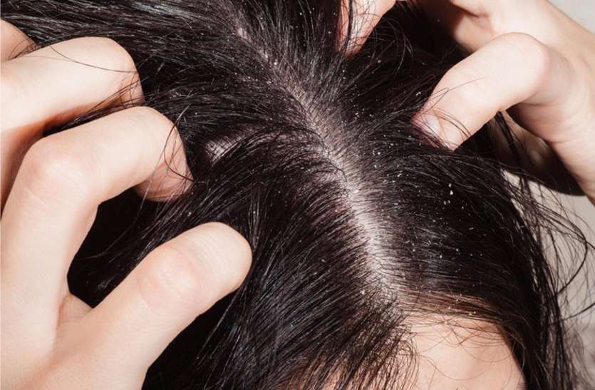 get-rid-of-head-itching-itchy-scalp-treatment-itchy-scalp