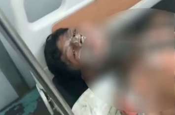 burnt victim died in varanasi hospital during treatment पिता के आरोप जय श्री राम न कहने पर मेरे बेटे को जलाया पर पुलिस का इनकार, इधर बेटे ने अस्पताल में तोड़ा दम