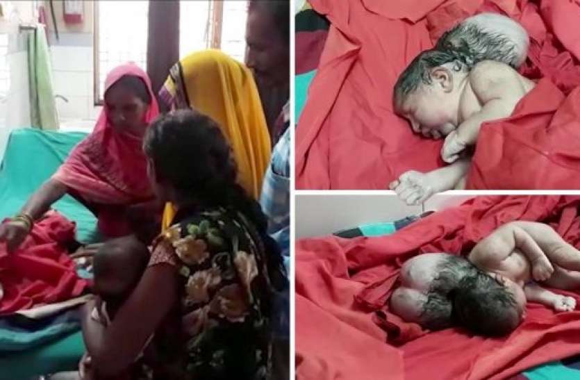 baby born यूपी के इस इलाके में तीन सिर वाली बच्ची ने लिया जन्म, लोग मान रहे हैं देवी का अवतार