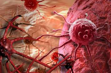 Cancer Patients In Haryana रोजाना 17 लोग आ रहे कैंसर की चपेट में