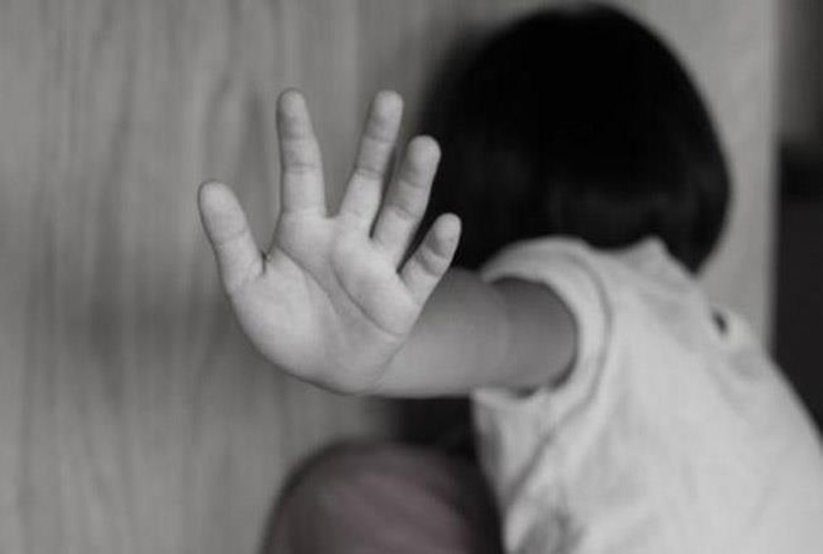 acid पत्नी पर करता था शक, एक दिन मारने पीटने के बाद तेजाब डालकर जला दिया यह हिस्स