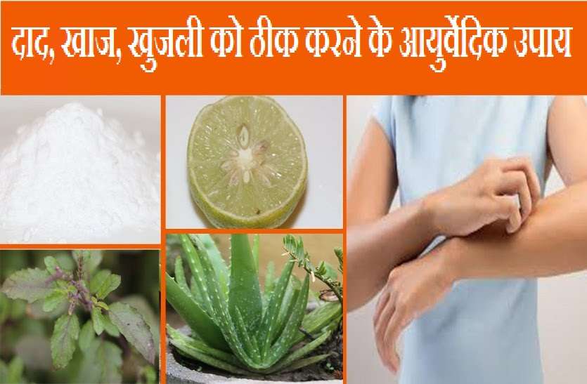 Ayurvedic Remedies बारिश के मौसम में दाद, खाज, खुजली को दूर करने के ये हैं 5 आयुर्वेदिक नूस्खे