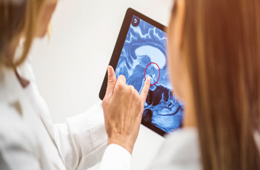 brain tumor हर मरीज में एक जैसे नहीं हाेते बे्रन ट्यूमर के लक्षण, जानिए सच