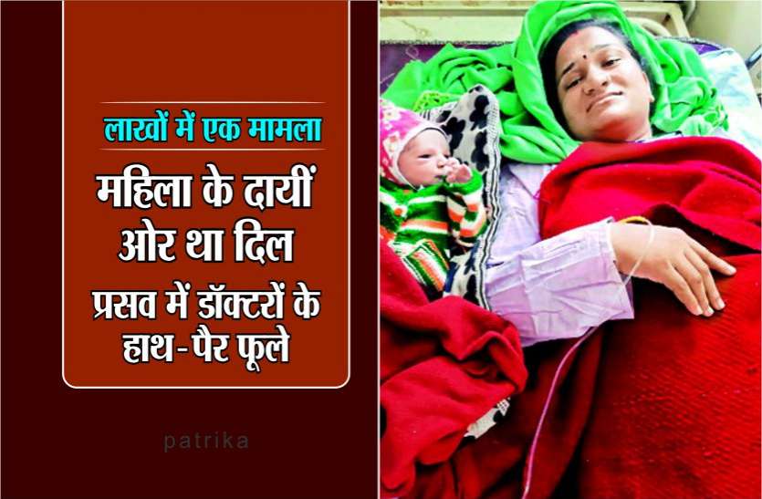 women महिला के दायीं ओर था दिल, प्रसव में डॉक्टरों के हाथ-पैर फूले, पति हिम्मत कर बोला- आप ही करो ऑपरेशन