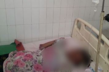 Father Death and daughter injured from burn in Basti #Crime गैस सिलिंडर रिसाव से लगी आग, बाप और बेटी झुलसी, पिता की मौत
