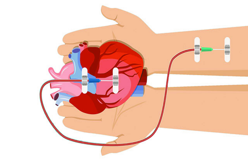 news world organ donation day 2019 : किसी ने खून का रिश्ता निभाया, तो कोई अपने अंगों से आज भी है हम सब के बीच