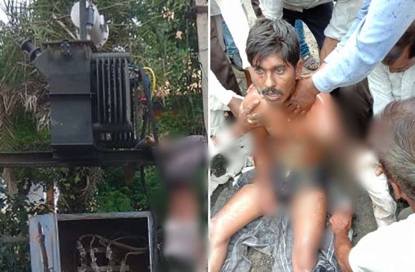 dhar डीपी पर काम कर रहा था कर्मचारी, अचानक चालू हुई लाइन, भयानक करंट से कटकर अलग हो गया हाथ