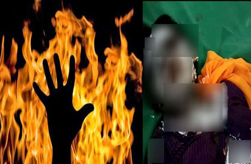 Demo pic हैवान पति ने पत्नी को जिंदा जलाया, 90 फीसदी झुलसी महिला, हालत गंभीर
