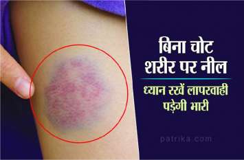 our body gives Signals of illnesses आपका शरीर भी देता है बीमारियों का संकेत: जानिये कैसे बिना चोट के पड़ जाती है नील, ना बरतें लापरवाही