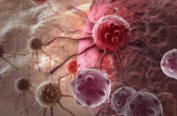 Scientists find cure for breast cancer turns cancer cell into fat cell वैज्ञानिकों ने खोजा स्तन कैंसर का इलाज, फैलने से रोकने के लिए कैंसर सेल्स को बदला फैट सेल्स में
