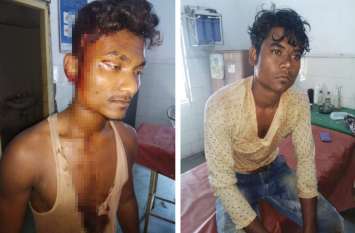 Knife atttack: Young girl knife attack on 3 young man मीना बाजार में युवती ने 3 युवकों पर चाकू से किया हमला, एक की हालत गंभीर, ये बात आ रही सामने