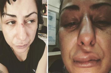 Hard Kaur pics goes viral after post video abusing PM Modi, Amit shah रैपर हार्ड कौर पर को भारी पड़ा मोदी और अमित शाह को अपशब्द कहना, हुआ हमला, पहचनना हुआ मुश्किल