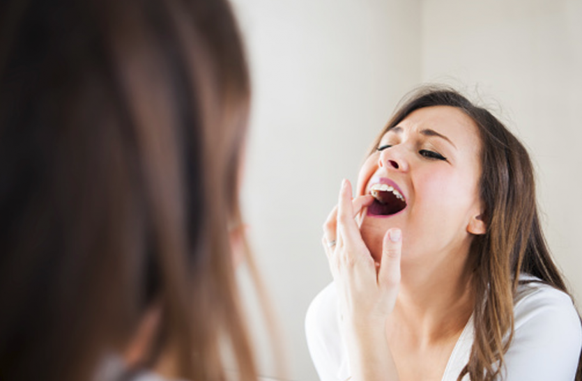 mouth sore कमजोर इम्यूनिटी से होते हैं मुंह में छाले