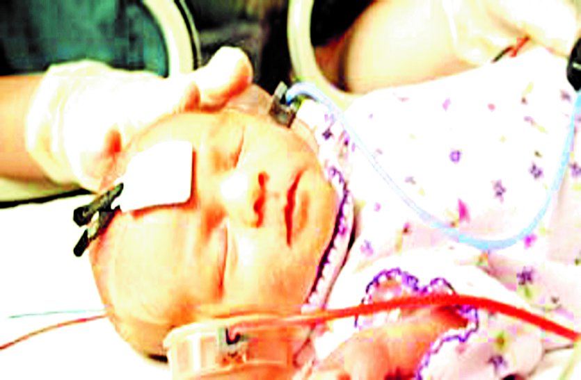 169 children die in a year and a half इस जिले के बच्चे अपना पहला जन्मदिन भी नहीं मना पाते, डेढ़ साल में 169 बच्चों की मौत