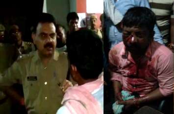 BJP Leader Brother Condition Critical after Police Beaten Brutallly पुलिस की पिटायी से भाजपा पदाधिकारी के भाई की हालत नाजुक, विवाद के बाद आधा दर्जन लोगों पर टूट पड़े पुलिस वाले