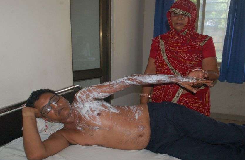 Jewelers father-son throws acid, four scorched ज्वैलर्स पिता-पुत्र पर फैंकी तेजाब, चार जने झुलसे