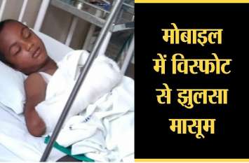 mobile blasted while charging, kid injured चार्जिंग के दौरान फटा मोबाइल , 10 वर्षीय बालक झुलसा