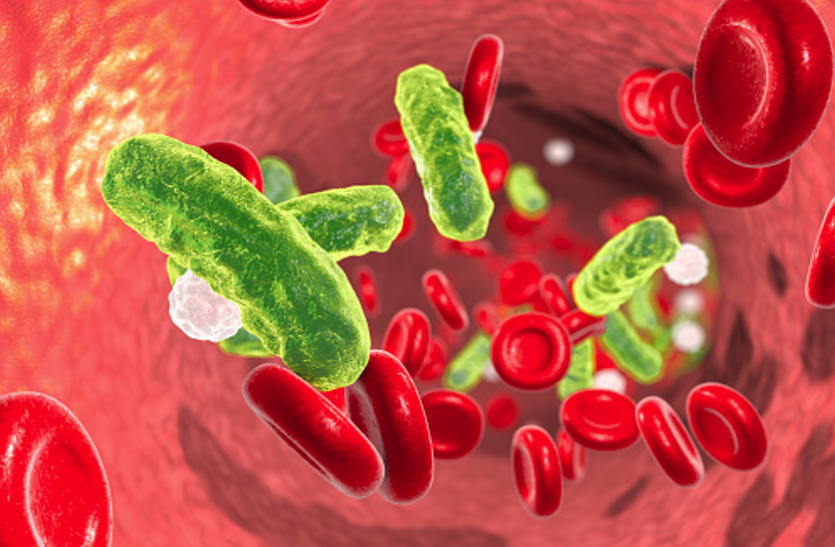 Septicemia - खून में इंफेक्शन से फैलता है सेप्टीसीमिया, ये हाेते हैं लक्षण Septicemia - खून में इंफेक्शन से फैलता है सेप्टीसीमिया, ये हाेते हैं लक्षण