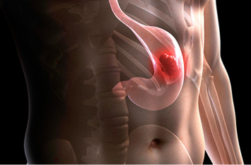 food pipe cancer symptoms and treatment धूम्रपान व एसिडिटी की वजह से भी हो सकता है फूडपाइप का कैंसर