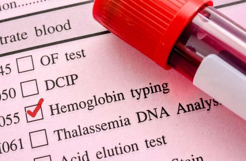 Polycythemia Vera : बढ़ जाता है हीमोग्लोबिन का स्तर Polycythemia Vera : बढ़ जाता है हीमोग्लोबिन का स्तर
