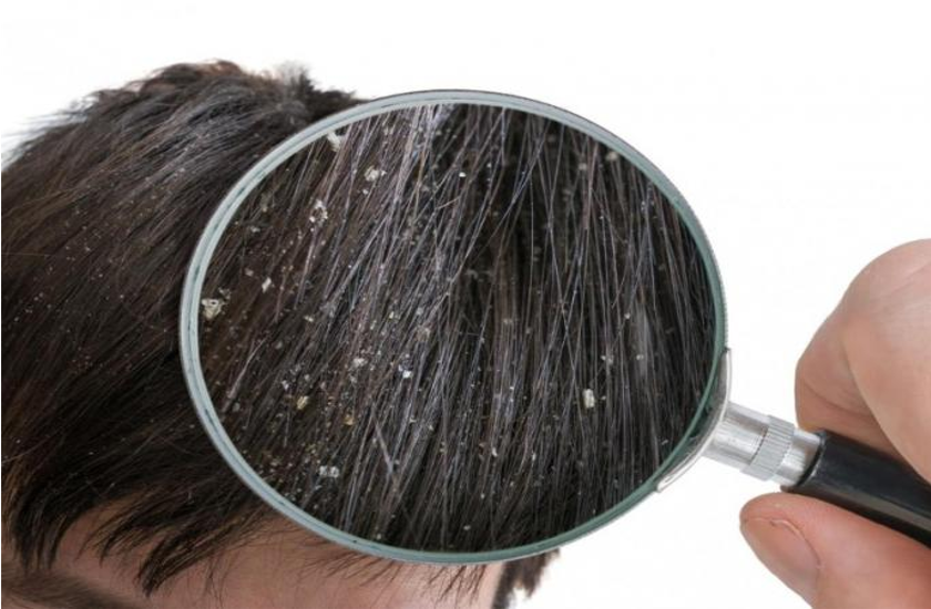 Fungal Infection treatment