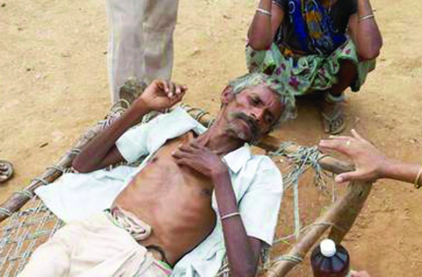Patients suffering from severe disease of silicosis on bed