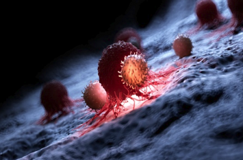 chronic myeloid leukemia causes, symptoms and treatment chronic myeloid leukemia - तेजी से फैलती हैं ब्लड कैंसर की कोशिकाएं