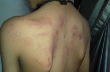 school teacher misbehave story छह साल के मासूम को पीट-पीटकर कर दिया लाल, फिर टीचर बोलीं- अपना बेटा समझकर मारा