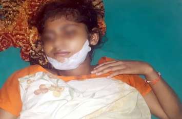mother pushes daughter from roof in shamli सौतेली मां ने बेटी को छत से दिया धक्का, पीड़िता की आपबीती सुन रो पड़ेंगे आप