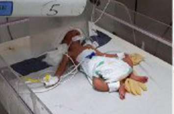 girl child in india news मां का पता नहीं, गंभीर अवस्था में अस्पताल छोड़ रफूचक्कर हुई वृध्दा तो नवजात को इन्होंने दिया सहारा