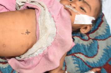 six-month-old was fired with hot wire in bhilwara फिर अंधविश्वास का शिकार बनी छह माह की मासूम, गर्म तार से दाग कर लगाया डाम