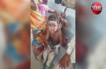 Gas leaks 5 scorches while cooking MDM in primary school of Banaras mid day meal बनाते गैस लीकेज से बड़ा हादसा, मासूम सहित 5 झुलसे