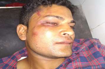 Alwar Young Men Shot Barber For Hair Cutting Issue In Mator Alwar अलवर जिले में बढ़ रहा अपराध, अब कटिंग कराने की बात पर युवक ने मार दी गोली
