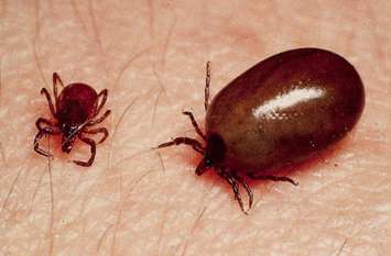 scrub typhus symptoms in hindi and Woman Death In Ghaziabad Scrub Typhus: उत्तराखंड और हिमाचल के बाद यूपी में फैली यह जानलेवा बीमारी, जानिए क्या हैं लक्षण और बचाव