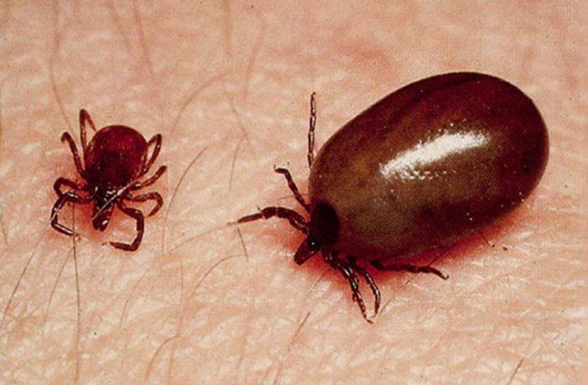 scrub_typus.jpg Scrub Typhus: उत्तराखंड और हिमाचल के बाद यूपी में फैली यह जानलेवा बीमारी, जानिए क्या हैं लक्षण और बचाव