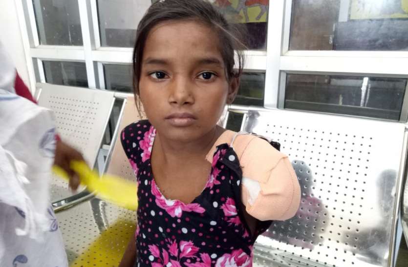 The doctor had to bite his hand due to carelessness डॉक्टर की लापरवाही से काटना पड़ा हाथ