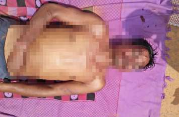 Chhattisgarh Murder: young man murdered by unknown man रातभर घर नहीं आया था पति, सुबह नींद खुलते ही पत्नी निकली बाहर, देखा तो चबूतरे पर पड़ी थी पति की लाश, फिर...