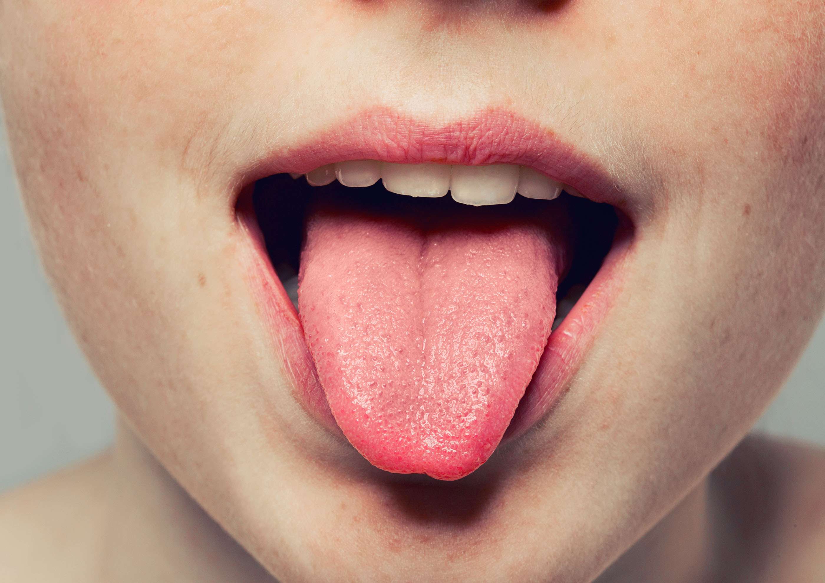 Tongue colour Says About Your Health | अपनी जीभ के रंग से जानिए आप किसी