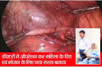 Kota doctors did amazing, rare operation done, woman now healthy कोटा के डॉक्टरों ने किया कमाल, कर दिया दुर्लभ ऑपरेशन, महिला स्वस्थ