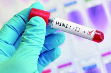 Swine flu has killed 206 in state, now it is coming again इस साल प्रदेश में 206 की जान ले चुका है स्वाइन फ्लू, अब फिर आ रही है आहट