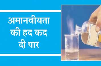 The bloodthirsty father first burnt the child from the press and then जालिम पिता ने पहले बच्चे को प्रेस से जलाया फिर पनी पर फेंका तेजाब