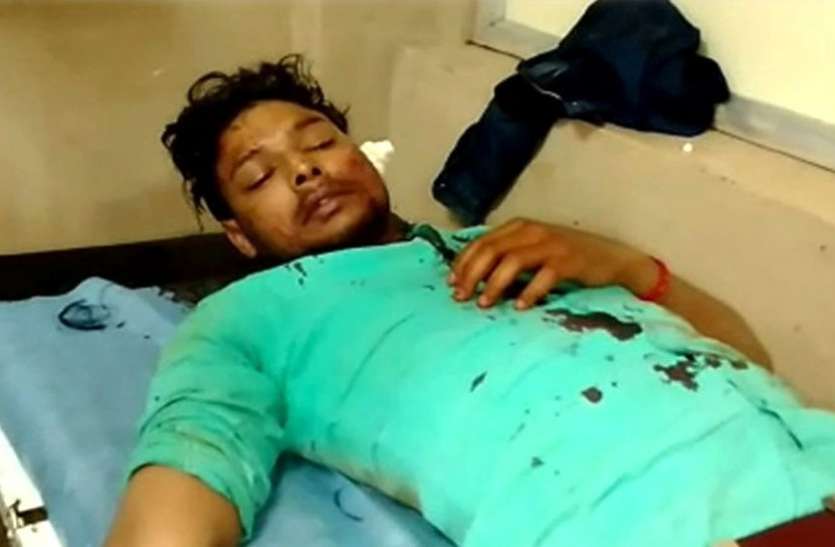 लूट के लिए बैंक फाइनेंस कर्मचारी की आंख में डाली मिर्च, पत्थर से सिर फोड़ा लूट के लिए बैंक फाइनेंस कर्मचारी की आंख में डाली मिर्च, पत्थर से सिर फोड़ा