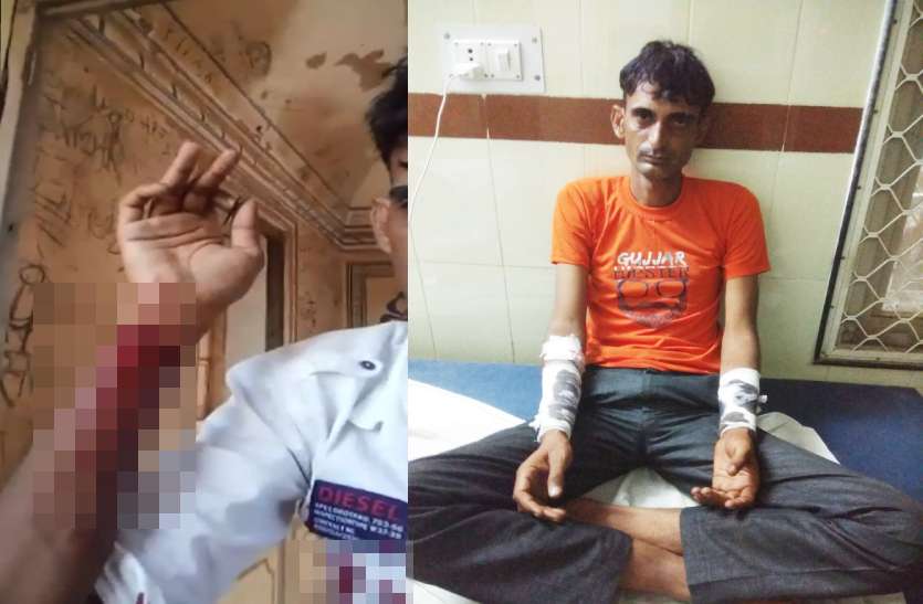 फोन पर पत्नी से बात करने से परेशान पति ने हाथों की नसें काटी, गंभीर हालत में अस्पताल में भर्ती फोन पर पत्नी से बात करने से परेशान पति ने हाथों की नसें काटी, गंभीर हालत में अस्पताल में भर्ती