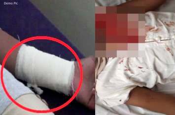 children watched serial and made false kidnap story due to study sikar पढ़ाई के डर से 10 साल के दो भाइयों ने सीरियल देख रची खौफनाक कहानी, एक ने खुद को ब्लेड से काटा