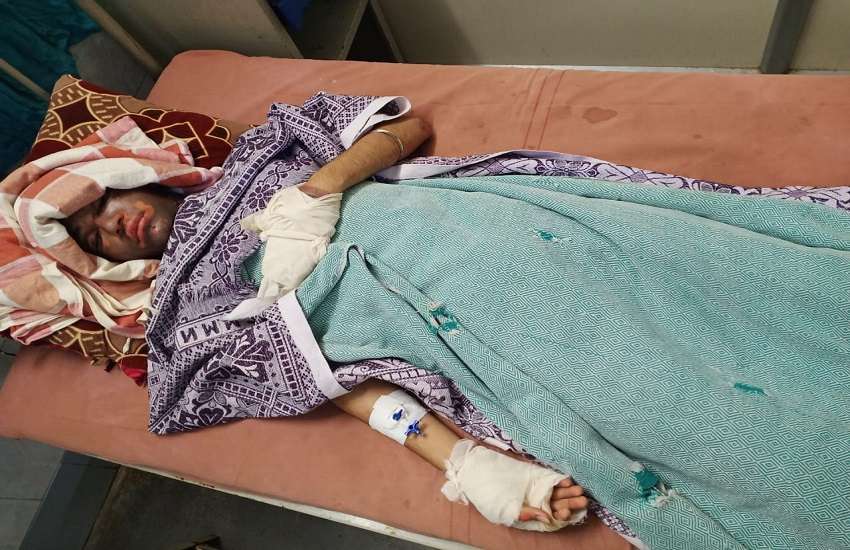 MSEB बिजली विभाग ने युवक का जीवन किया बर्बाद