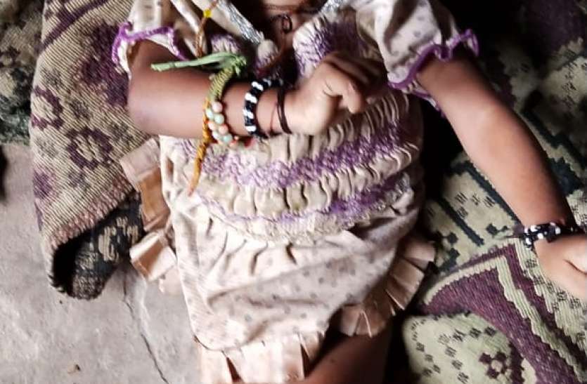 sheopur कुपोषण छीन रहा बचपन, दो वर्षीय कुपोषित बच्ची की मौत