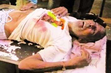 Two parties clashed in land dispute, a dozen injured जमीन विवाद में दो पक्ष भिड़े, दर्जनभर घायल