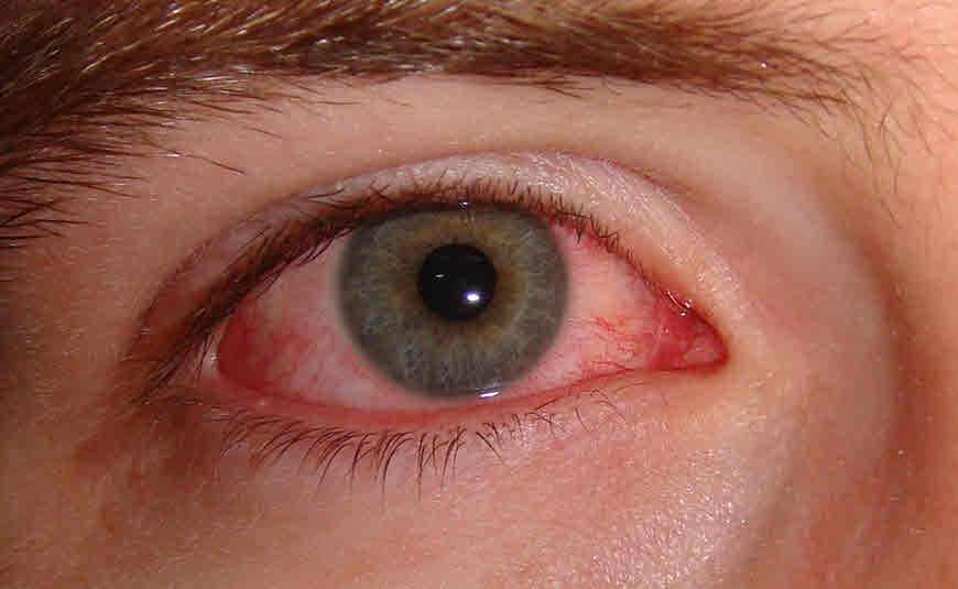 red-eyes.jpg