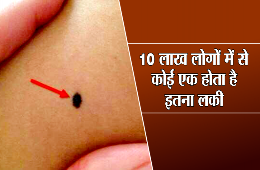 lucky body mole 10 लाख लोगों में से कोई एक होता है इतना भाग्यशाली, जिसके इस खास स्थान पर होता है तिल
