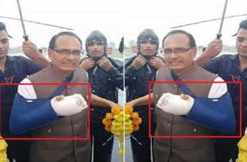 shivraj singh chouhan did not fake injury on his hand photo goes viral फेक अलर्ट: शिवराज सिंह के कौन से हाथ में है फ्रैक्चर दाएं या फिर बाएं? जान लीजिए सच्चाई